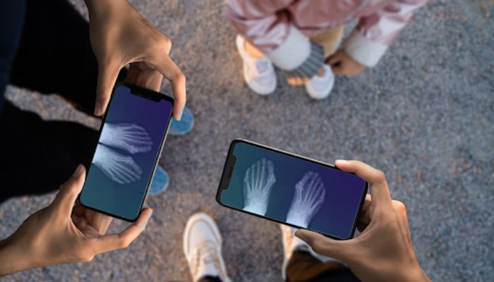 Aplicativo de Raio X pelo celular - app gratuito e fácil de usar