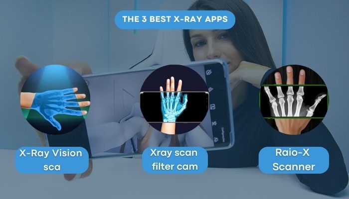 X-ray app on your cell phone – free and easy to use app