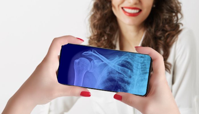 X-ray app on your cell phone – free and easy to use app