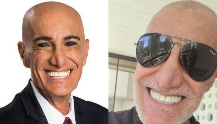 How I would look bald app - Free and safe app
